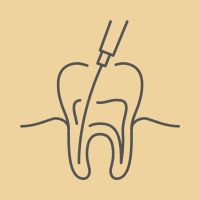 Root Canal